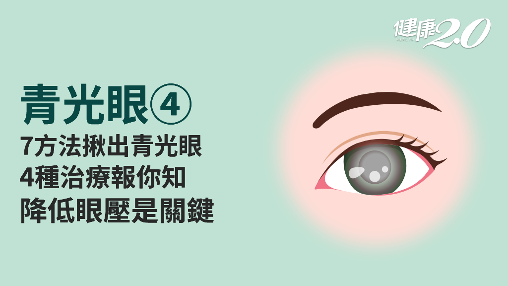 青光眼／診斷方法有哪些？4種治療降眼壓 3種人注意用藥安全