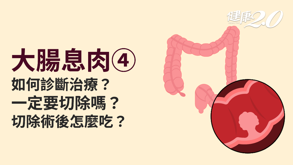 大腸息肉／如何發現大腸息肉？2情況須切除大腸息肉 術前、術後要注意什麼？