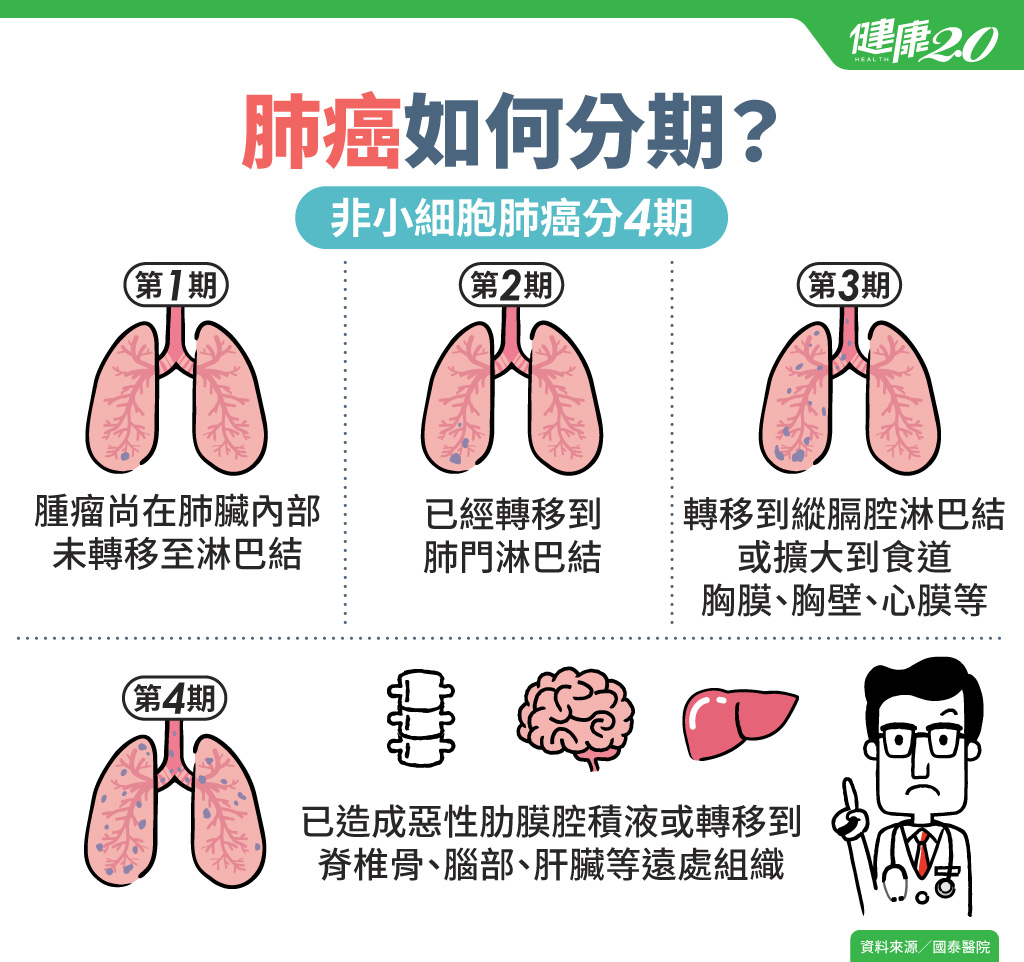 肺癌有哪些前兆？預防肺癌吃什麼？誰是高危險群？症狀、分期、治療懶人包