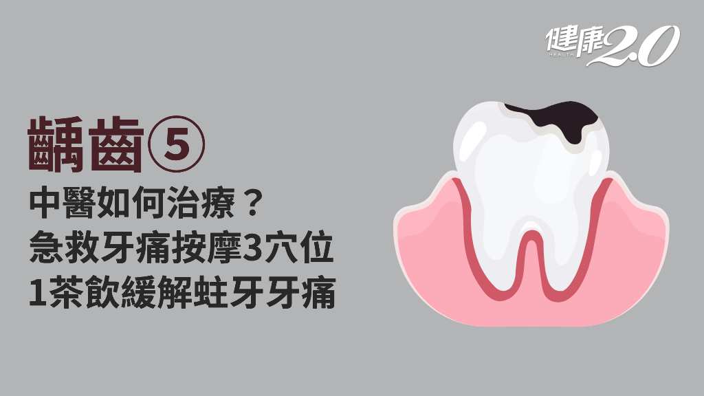 齲齒／中醫可以治療蛀牙？牙痛急救怎麼做？哪些穴位、茶飲可以緩解牙痛？