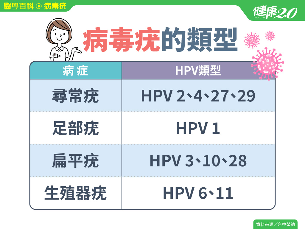 病毒疣／感染HPV形成皮膚病 赤腳、打麻將會傳染！病毒疣4類型 部位、症狀一次看