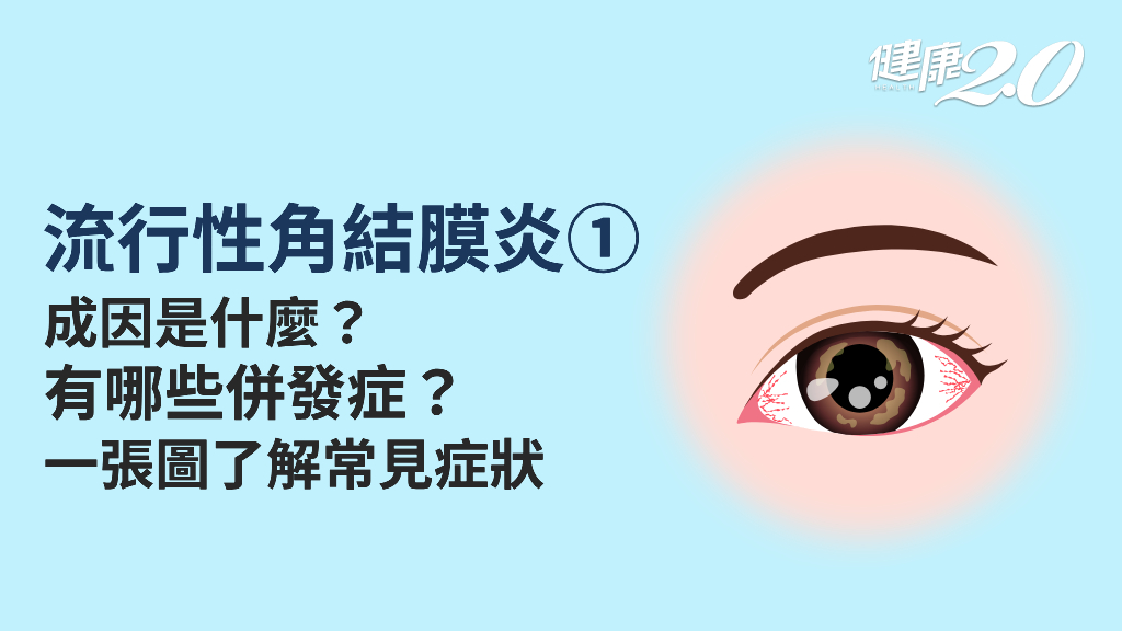 流行性角結膜炎／紅眼、眼屎多是流行性角結膜炎？為什麼發生流行性角結膜炎？流行性角結膜炎好發哪個季節？