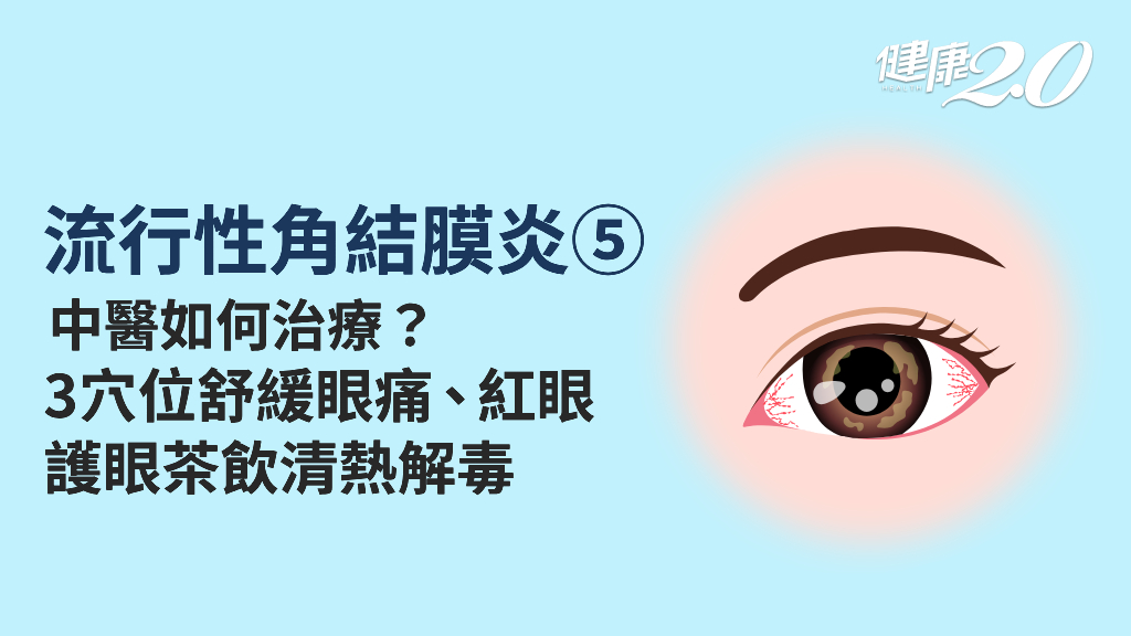 流行性角結膜炎／中醫如何治療流行性角結膜炎？哪些穴位可以舒緩眼痛、紅眼？護眼茶飲怎麼喝？