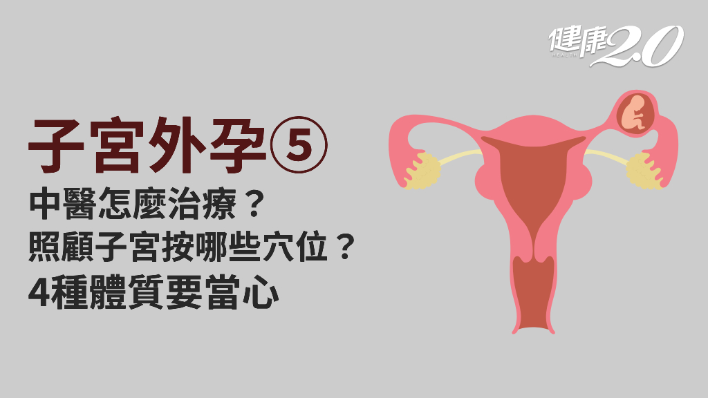 子宮外孕／中醫可以治療嗎？哪些體質最容易子宮外孕？8穴點養護子宮