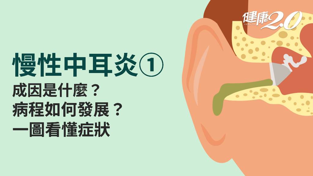 慢性中耳炎／為什麼會變成慢性中耳炎？症狀、病程一覽！嚴重恐神經麻痺