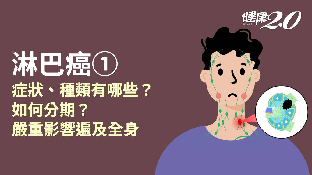 淋巴癌／淋巴癌有哪幾型？台灣常見的是哪種？主要症狀有哪些？