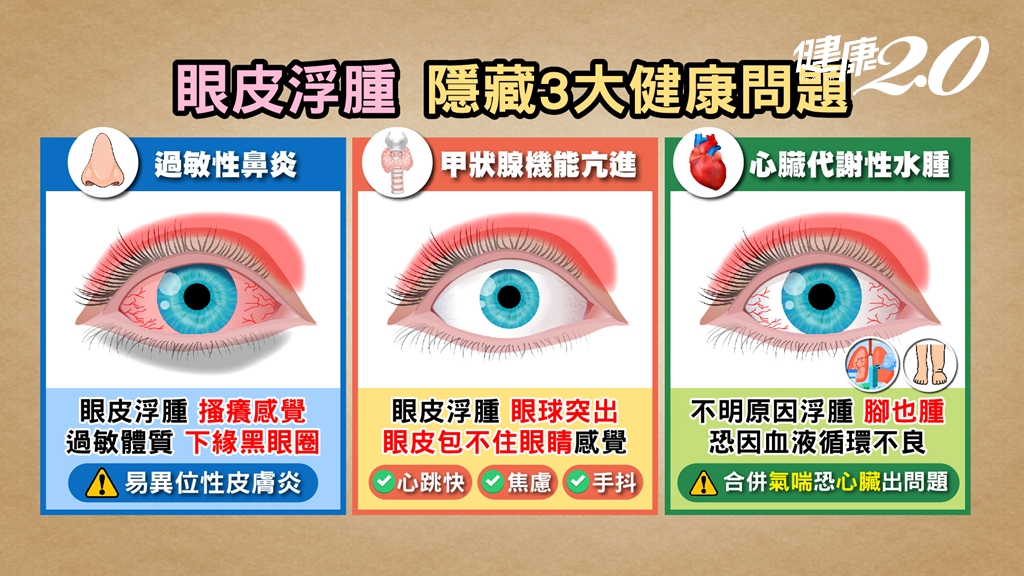 不只是疲勞！眼睛看出身體危機，教你觀察3種眼症狀 茶飲養眼護健康