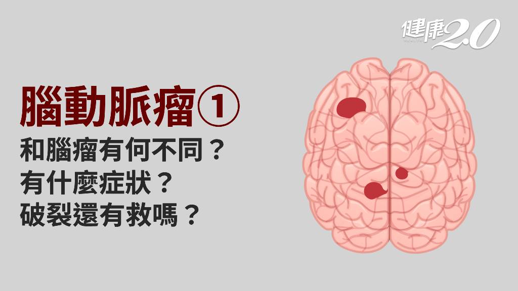 腦動脈瘤／腦動脈瘤有什麼症狀？會致命嗎？有什麼併發症？