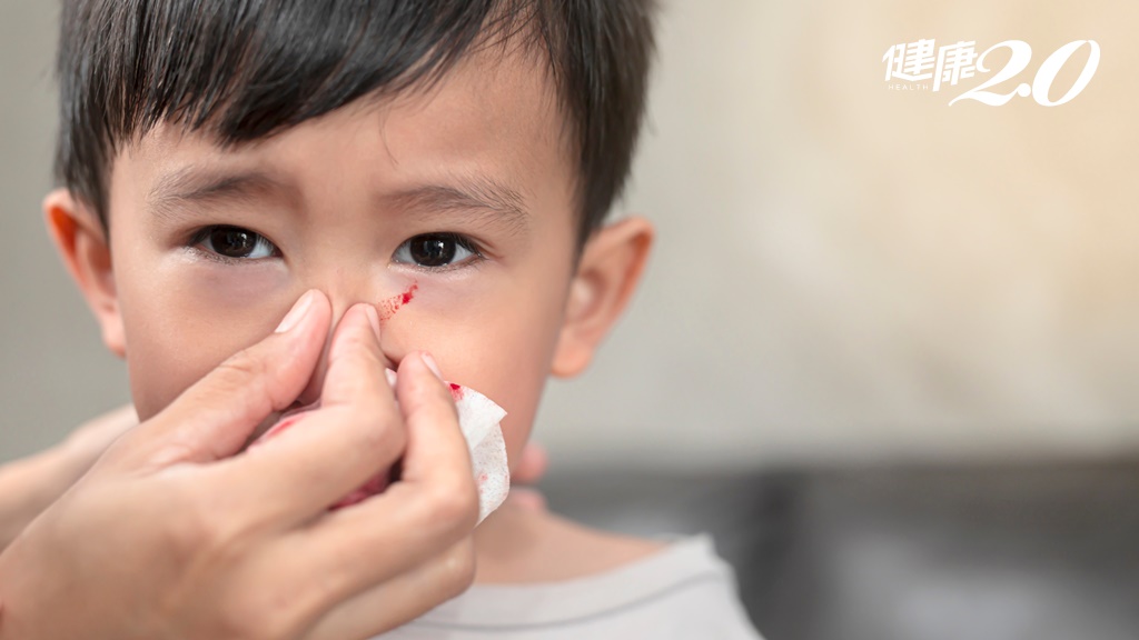 小孩總是流鼻血怎麼辦？中醫指出流鼻血可分為2證型 別只用小建中湯調理