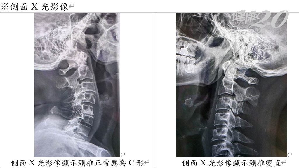 延伸閱讀