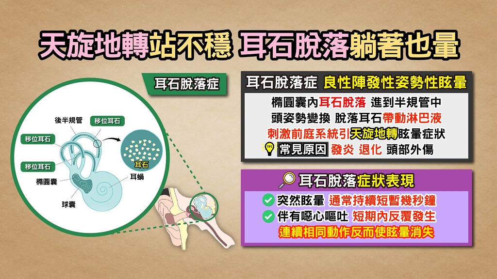 耳石移位 耳石脫落 症狀 原因 耳石移位 耳石脫落 症狀 原因