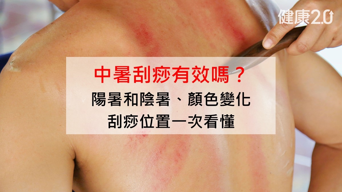 中暑刮痧有效嗎?陽暑和陰暑、顏色變化、刮痧位置一次看懂