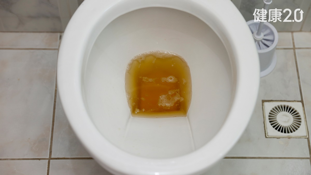 B肝帶原為什麼會變急性肝炎？沈玉琳忽略什麼？1症狀病情惡化了
