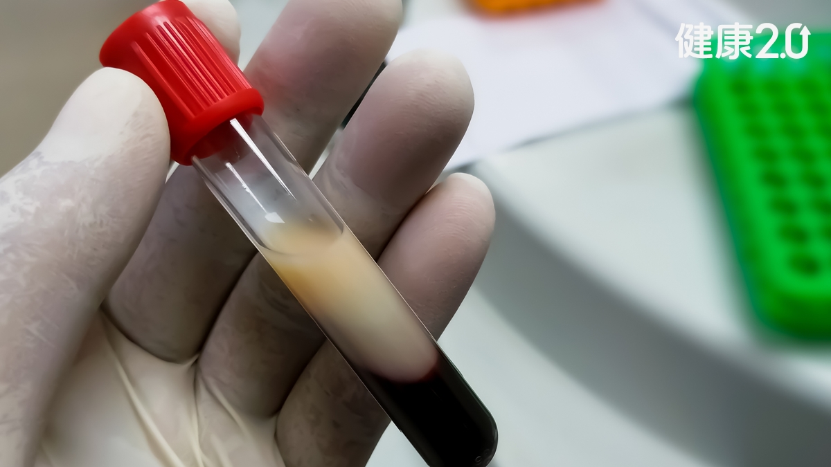 降血脂、膽固醇有新選擇!減少痠痛副作用 健保調降這藥門檻