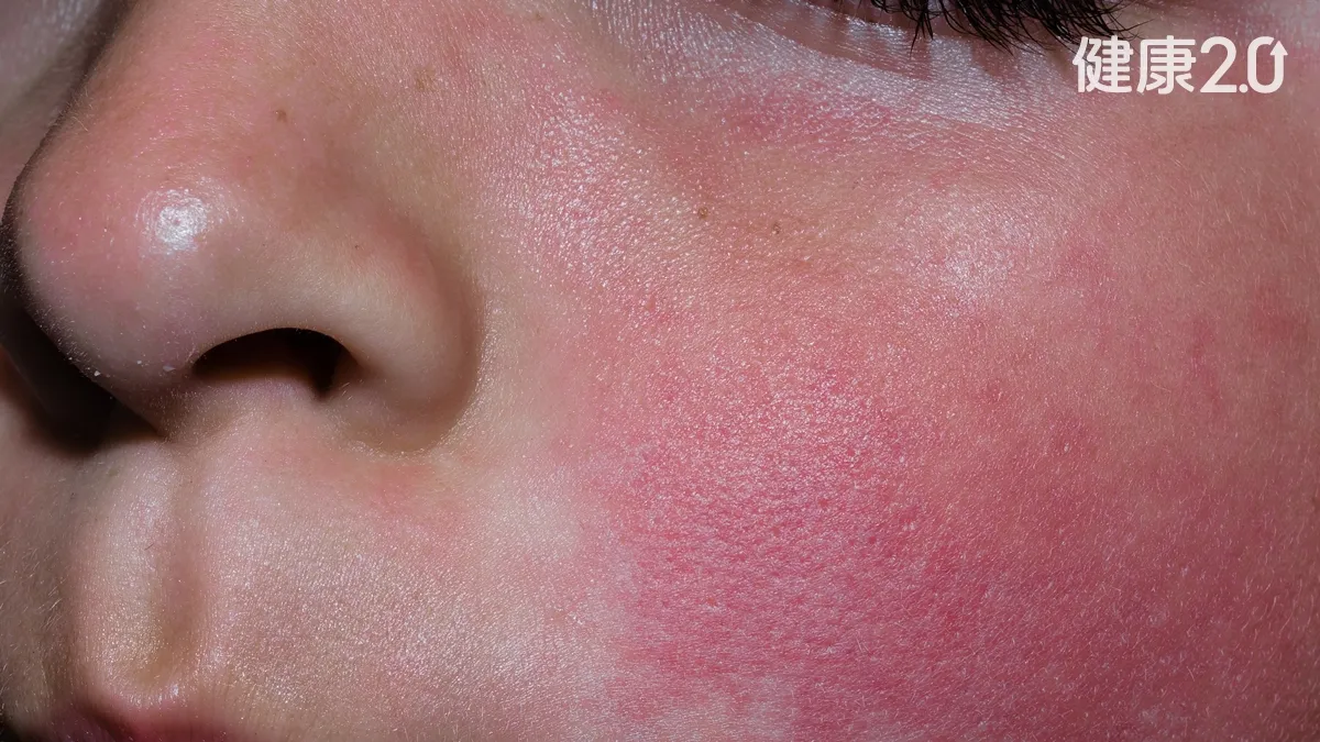 Search result thumbnail