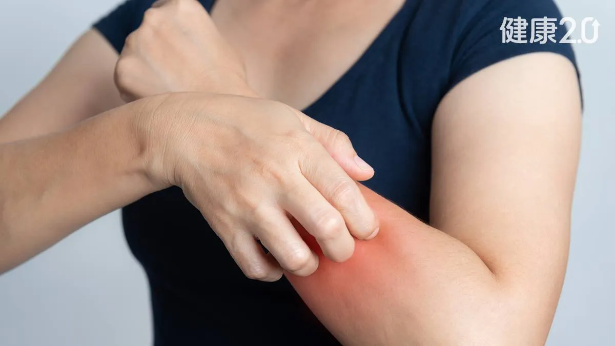 全身癢卻沒紅疹？恐是身體「這部位」在求救 2大關鍵特徵別輕忽