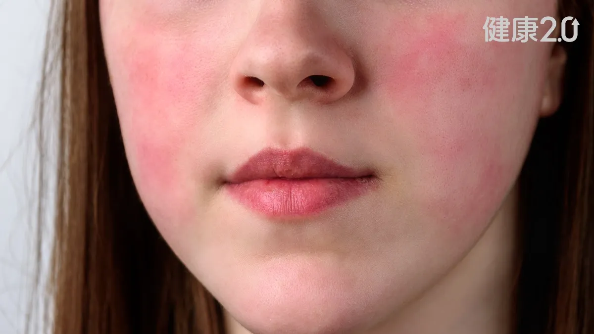 大叫一聲後猝死！女童疑染B19病毒 醫示警3族群須留意