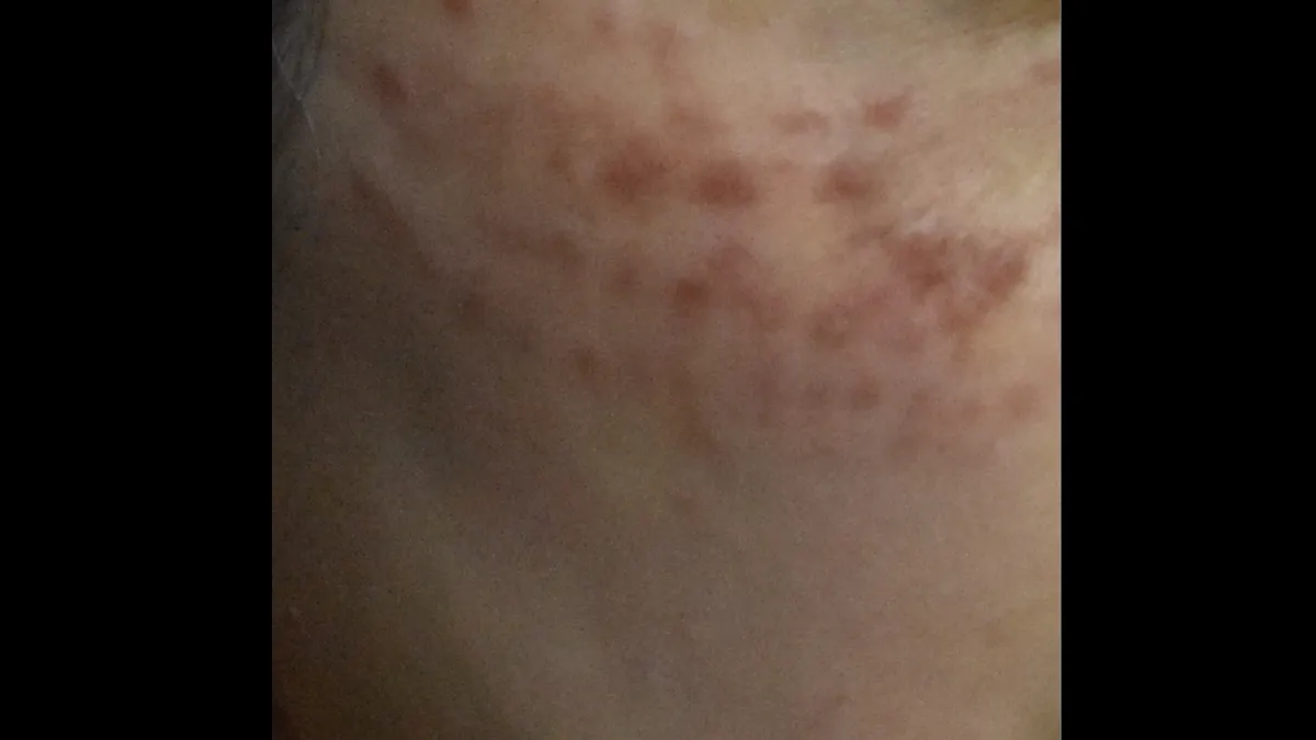 Search result thumbnail